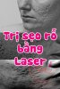 tri-seo-ro-bang-laser.jpg