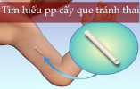 tim-hieu-pp-cay-que.png