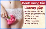 benh-sinh-nu-thuong-gap.jpg