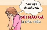 dau-hieu-smg-o-nu.jpg
